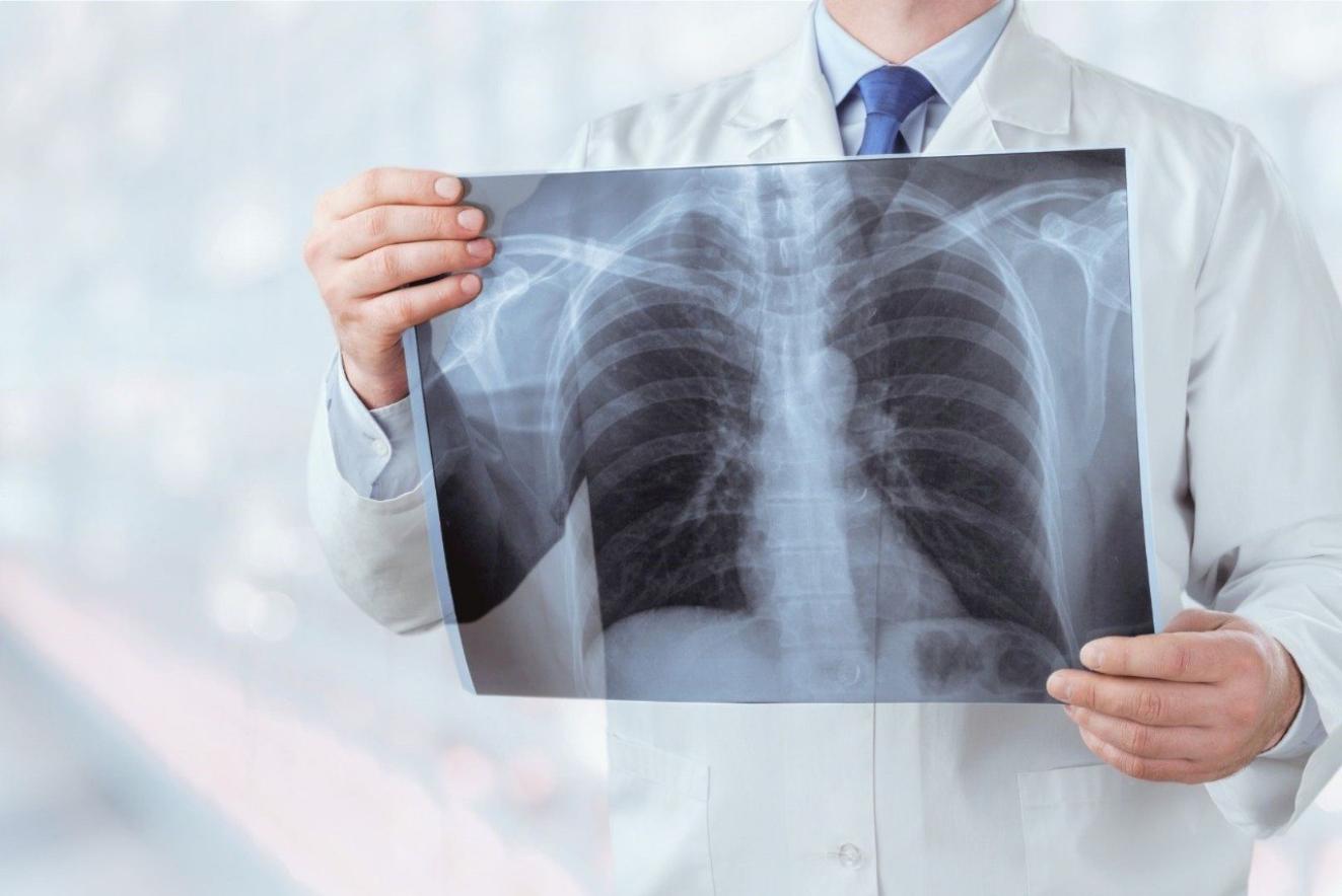 12 ноября - Всемирный день борьбы с пневмонией