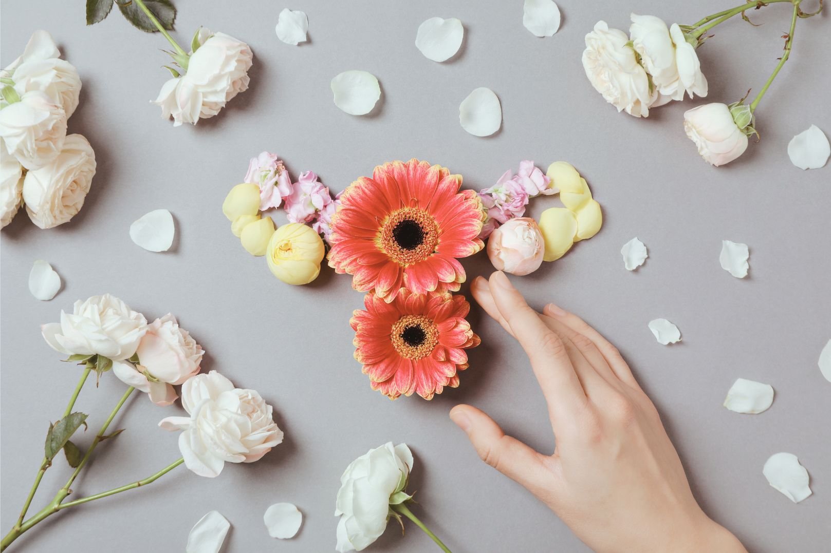 Синдром поликистозных яичников