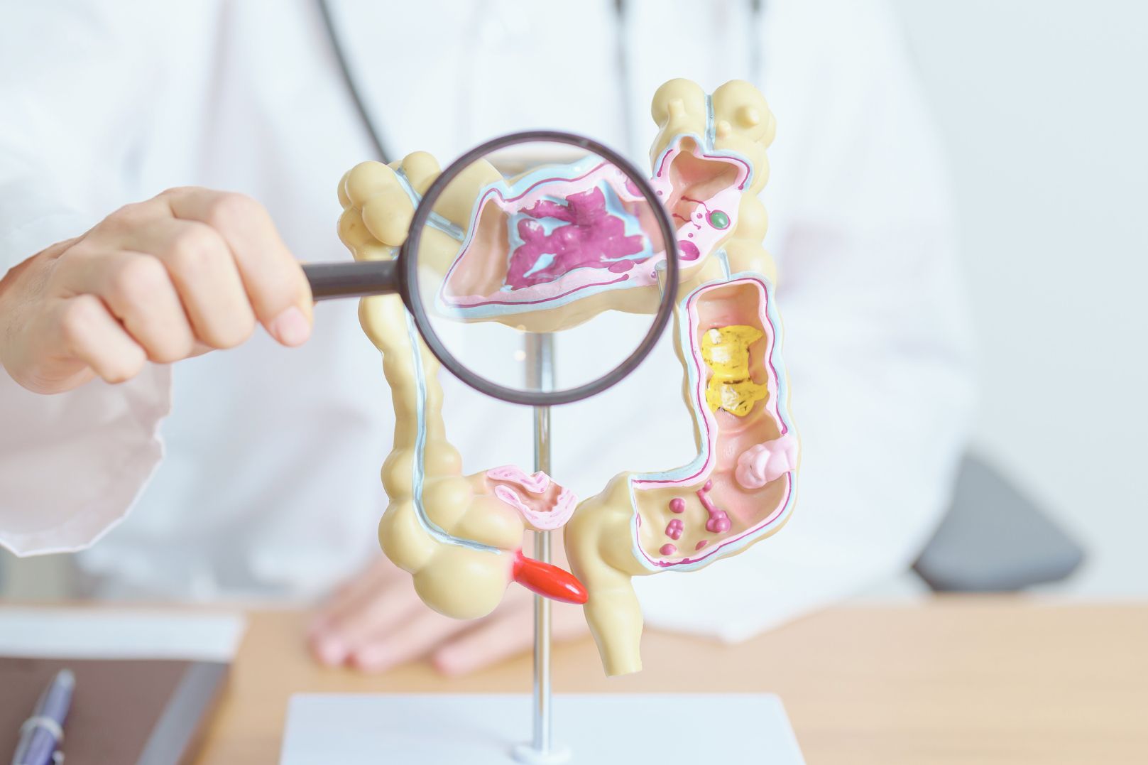 Пять мифов о раке толстой кишки